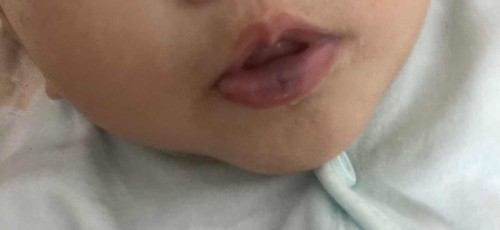 Bibir biru 😰