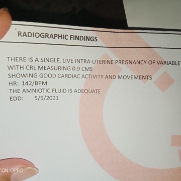 ultrasound