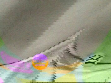 คันท้อง แพ้รึป่าวคะ