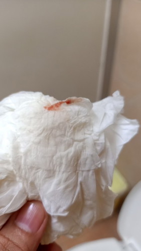 เลือดออก15w2d