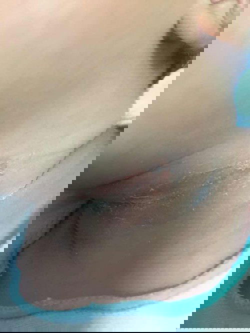 มียาอะไรแนะนำมั้ยค่ะ