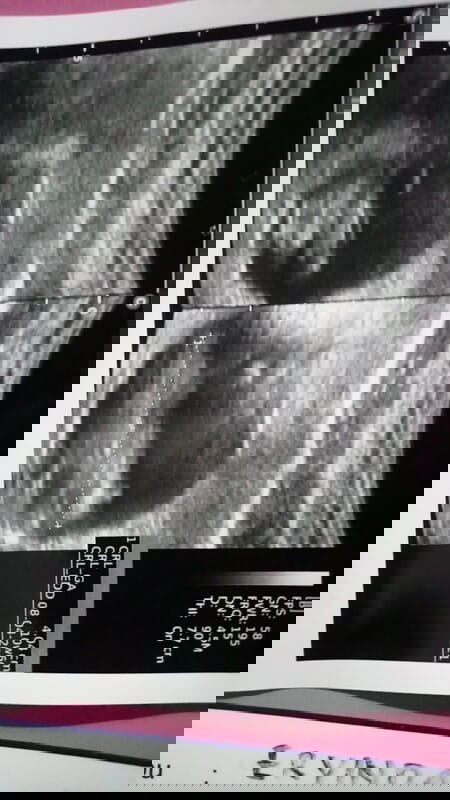 Hasil usg 10w bagaimana cara membaca usg, normal kah ini ?