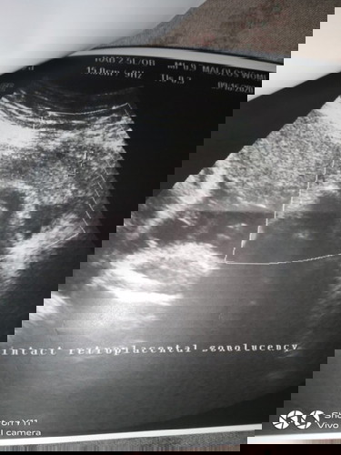 tanong ko lang po kung ano po ibig sabihin nang intact retroplacental sonolucency?im 34weeks tY po