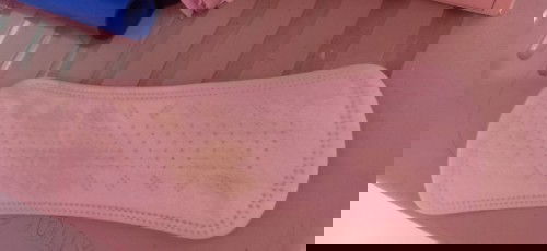 Is it normal having Yellow discharge during pregnancy , Im 14th weeks