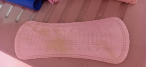 Is it normal having Yellow discharge during pregnancy , Im 14th weeks