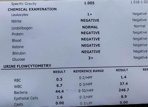 3+ Glucose urinalysis