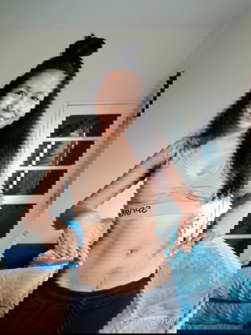 แชร์รอยแผลความเจ็บปวดที่สวยงามกันแม่ๆ