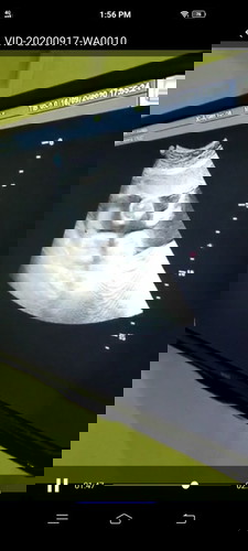 Bun pernah ngalamin gak usia 7bulan usgx cwek.. dan kata dkter 80% cwek ankx.. maux cwok bund