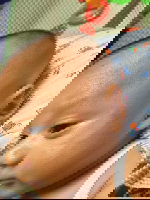 Obat untuk menghilangkan bekas luka