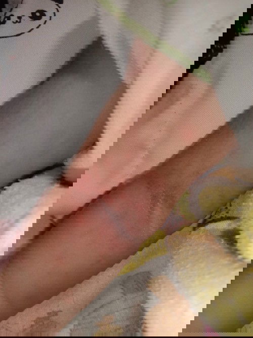 Ada yang tau obatnya apa?