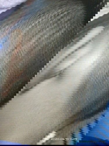 bukol sa likod ng tenga