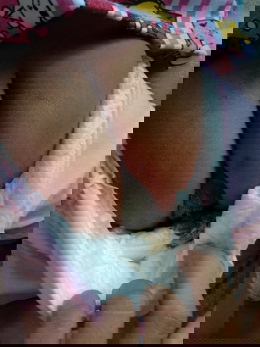 5เดือนอึแข็ง