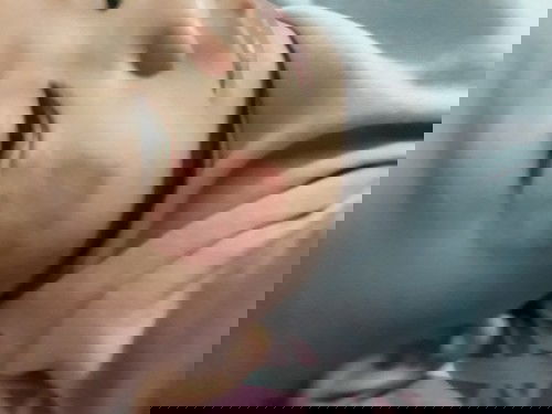 Eksim gatal pada bayi