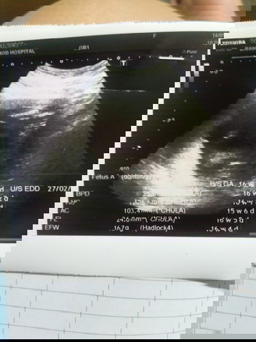 แม่ๆช่วยดูภาพอับตร้าซาวน์หน่อยค่ะ