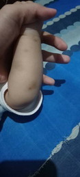 Hello po ask ko lng may mas mabisa pba po sa lighten up.
Di po kasi agad nawawala.
Thanks po........