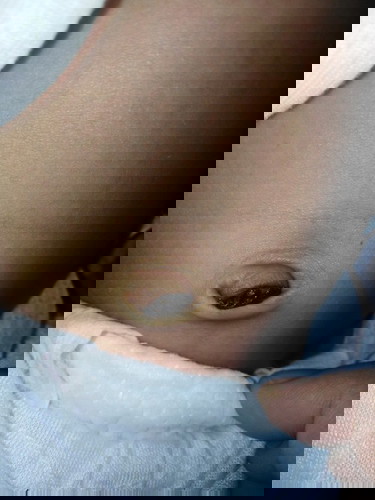Umbilical Cord