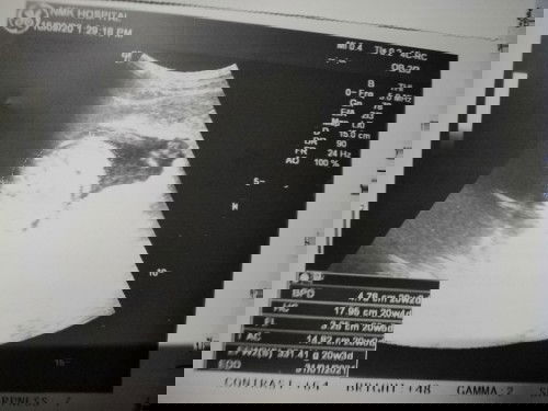 น้ำหนักลูกน้อยไปมั๊ย?