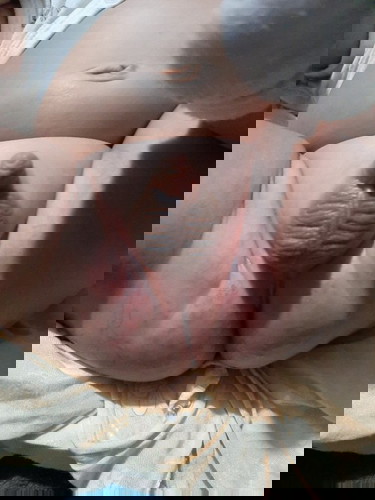 Rashes from Diarrhea?