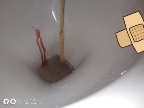 มีใครรู้บ้างคะมันเป็นอะไร