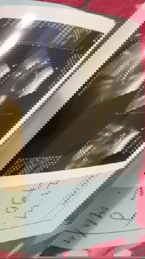 mungkin akibat minum yg manis manis dan makanan manis