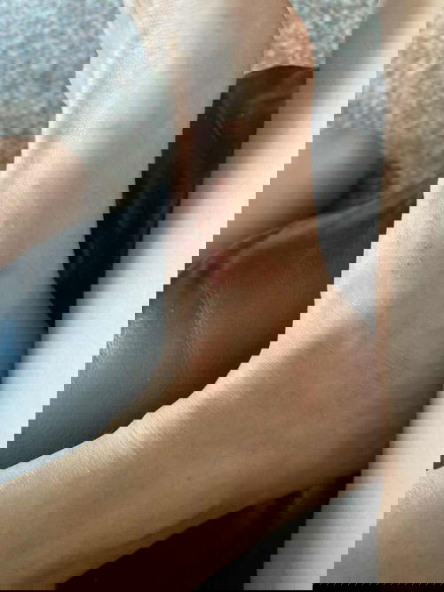 Is pregnant women tend to get more rash ?