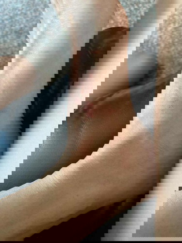 Is pregnant women tend to get more rash ?