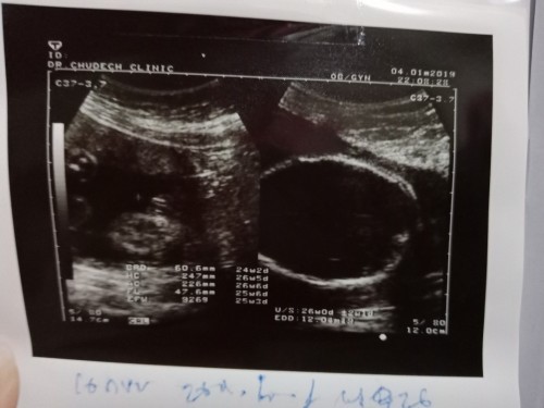 26week กำหนดคลอด เดือน ธ.ค จ้า