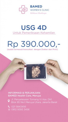 More info usg
