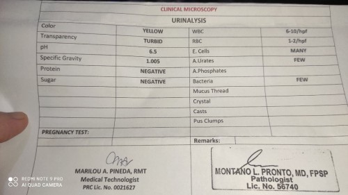 URINALYSIS RESULT