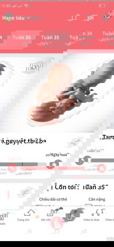 Bầu 35 tuần bị thiếu ối phải nằm viện e lo quá sợ đẻ non k ạ