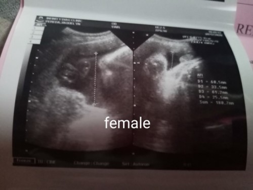 Baby girl π