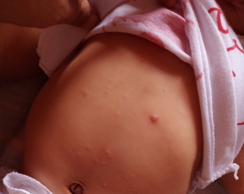 Help mga momshie..ano po kaya eetong tumutubo sa tiyan ni baby..dumadami po kase sya..TIA..