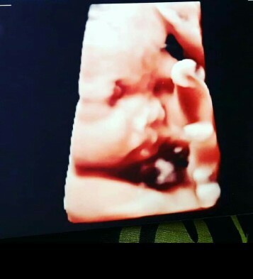 Sakit saat buang air kecil