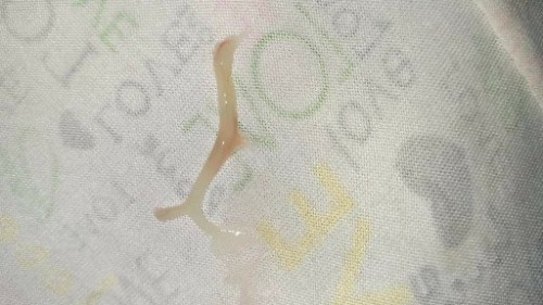 mucus plug