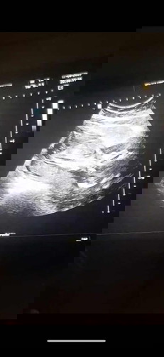 บี๋เอาหัวไปซุกในที่แคบ17week