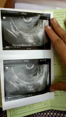 ทำไมซาวตอน8wยังไม่เจอตัวน้องเลยคะปกติซาวเห็นกันตอนกี่wคะตอนนี้แม่เป็นกังวลมากคะ