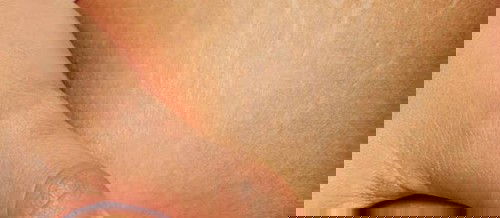 PENCEGAH STRETCH MARKS