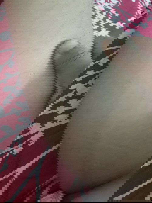 Line pelik di betis kaki