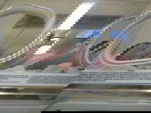 Penagalaman melahirkan caesar