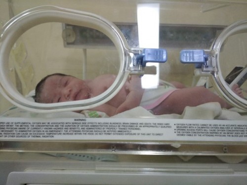 Penagalaman melahirkan caesar