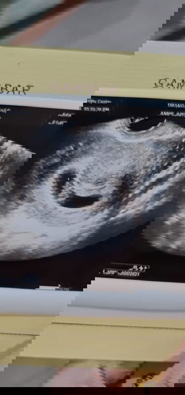 Belum tes darah dikasi asam folat 1000mcg