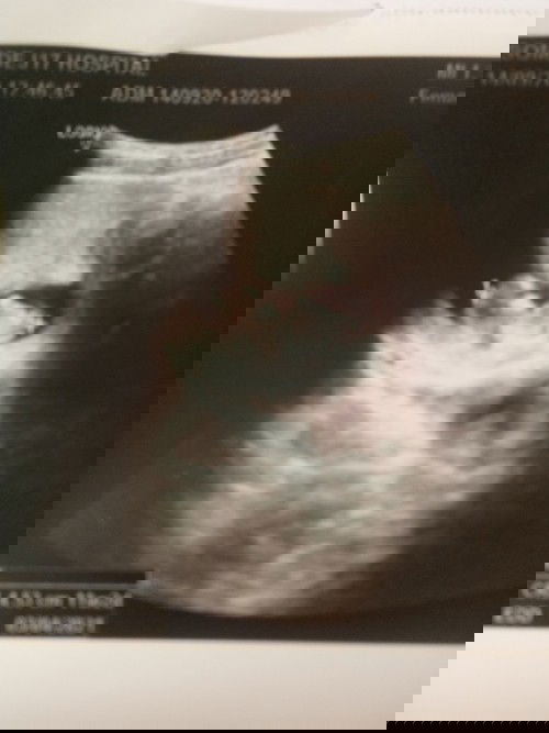 อยากเเน่ใจคะ