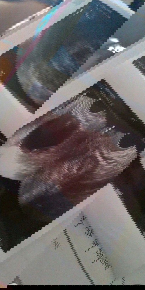 Ada kista di Rahim kanan