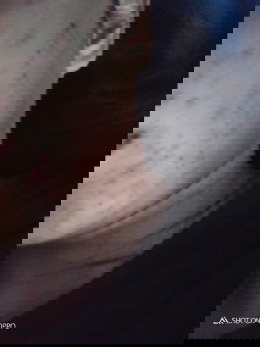 สิว / ผื่น/คัน