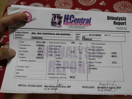 URINALYSIS REPORT