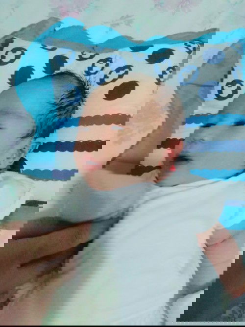 VBAC TEAM SEPT. Posterior placenta