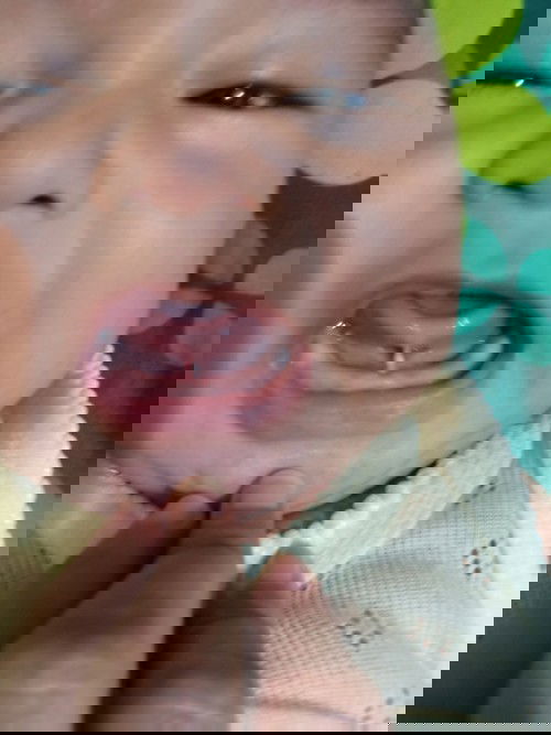 Benjolan di urat tali lidah