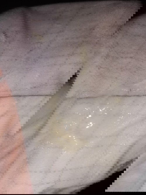 Parang egg white na discharge