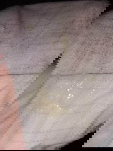 Parang egg white na discharge