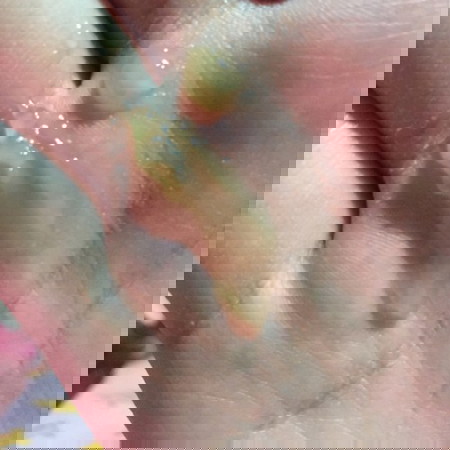 แบบนี้ปกติดีไหมคะแม่ๆ